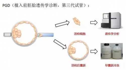 代怀孕的价格-孕酮正常吃黄体酮对胎儿有影响吗